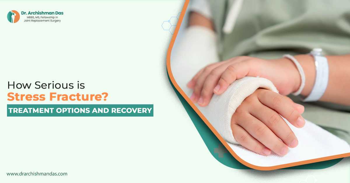 How Serious is Stress Fracture - Treatment Options and Recovery