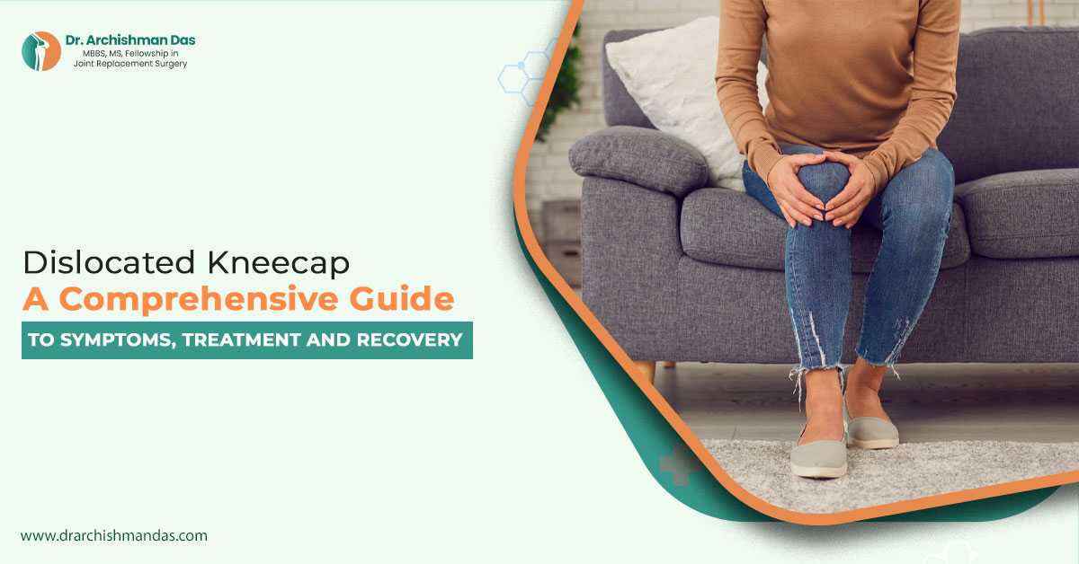 Dislocated Kneecap: A Comprehensive Guide to Symptoms, Treatment, and Recovery